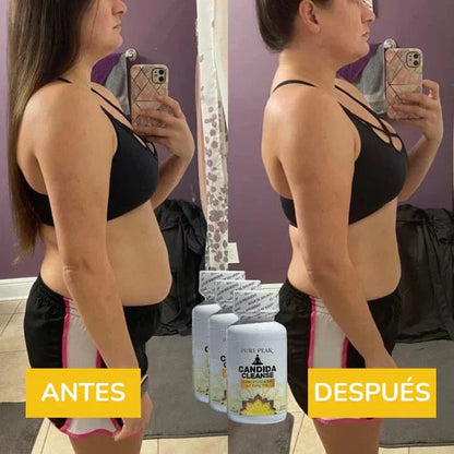 Candida Cleanse™ — Gut Balance Herbal Complex 🌿💚