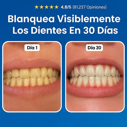 Dental Armor™ — Protección Líquida para Esmalte y Frescura 🦷💎